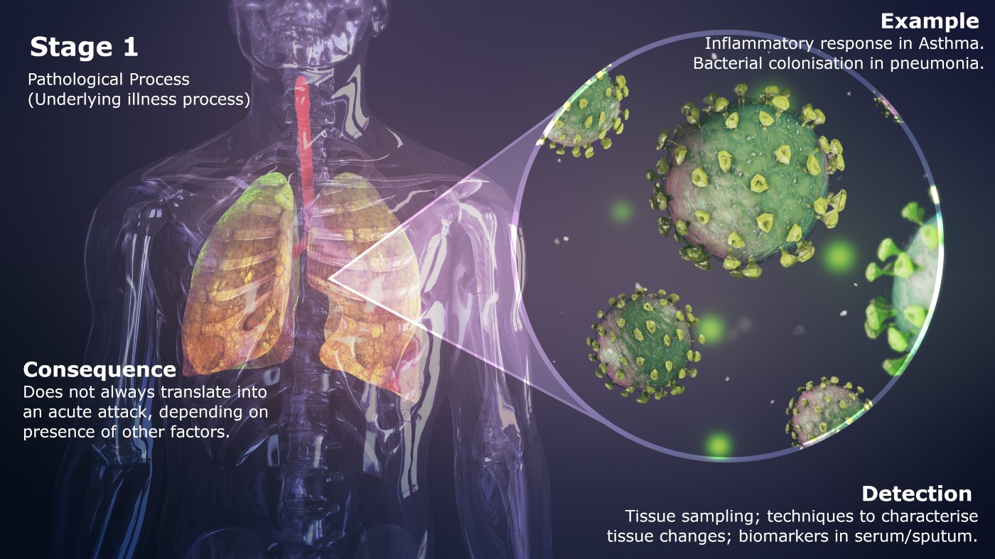 Stage 1 of Respiratory Illnesses
